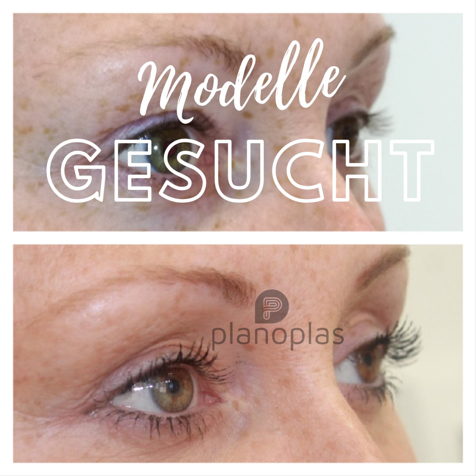 Modelle für Planoplas Behandlungen gesucht